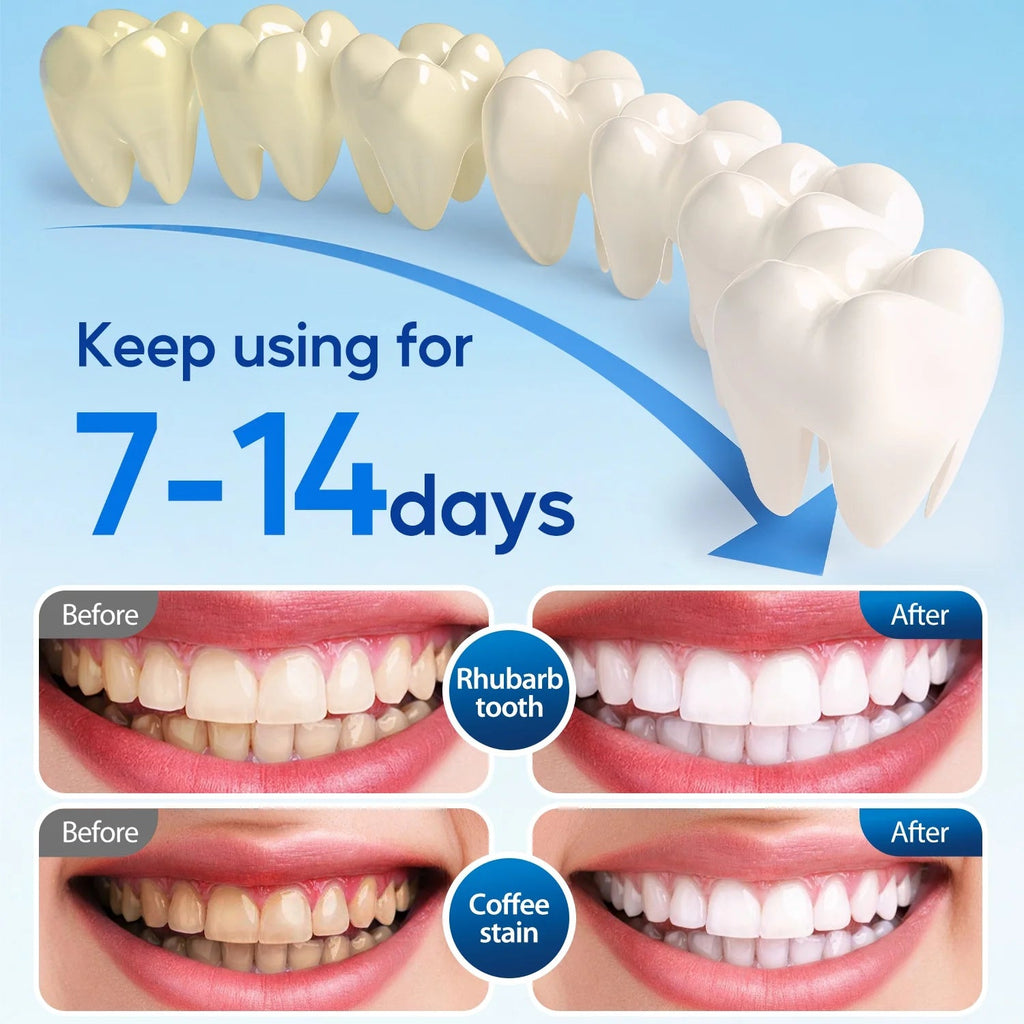 LED Teeth Whitening Strips Kit for Sensitive Teeth - 28 White Strips + 24 Blue Light Accelerator, 20Min Rapid White At - Home Dental Care for Smoking & Coffee Stains - thewrightstore