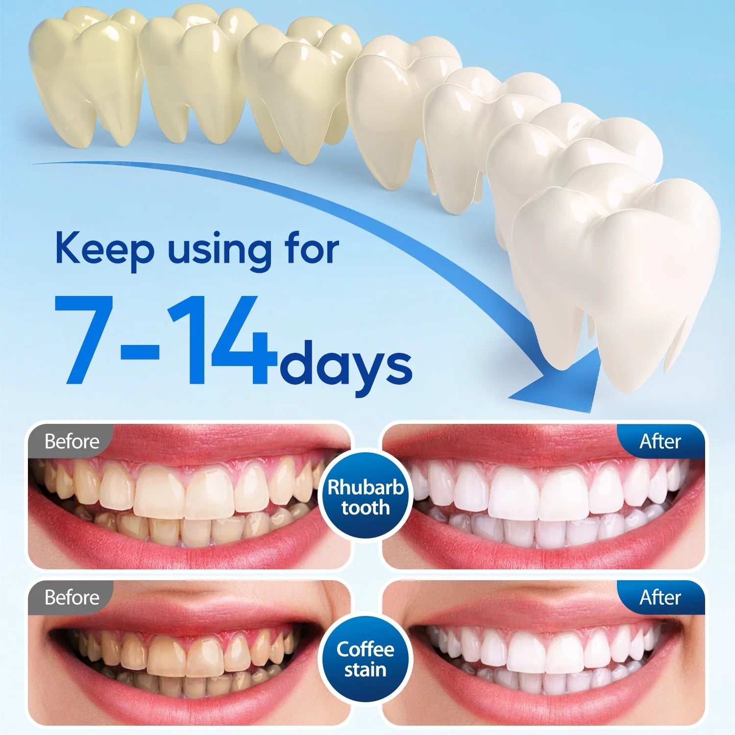LED Teeth Whitening Strips Kit for Sensitive Teeth - 28 White Strips + 24 Blue Light Accelerator, 20Min Rapid White At - Home Dental Care for Smoking & Coffee Stains - thewrightstore